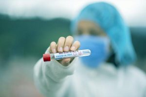 Covid cases steady